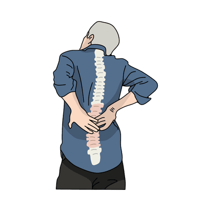 Остеопороз