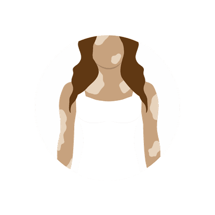 Пигментные пятна