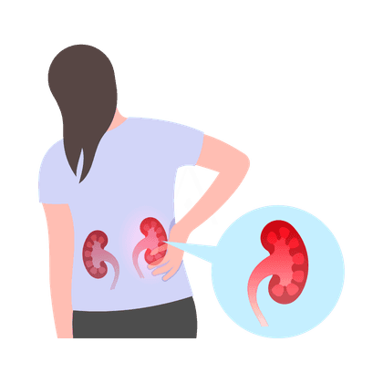 Мочекаменная болезнь